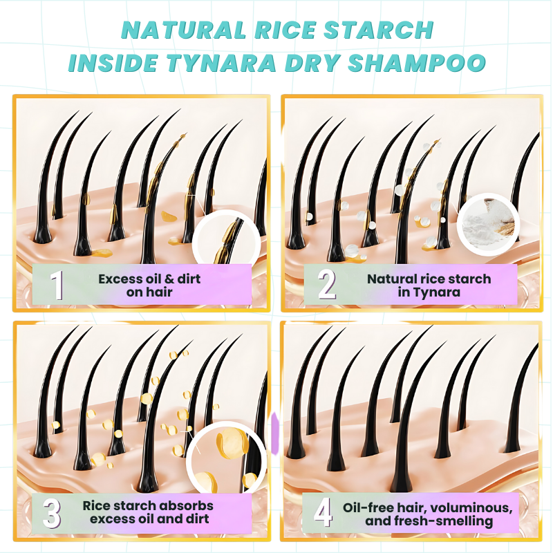 Tynara Dry Shampoo 200ml Natural Dry : Instant Oil Absorption, Fresh & Voluminous Hair